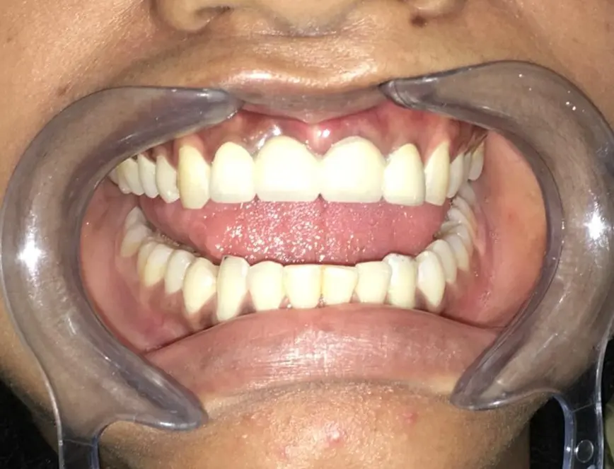 After dental case 5
