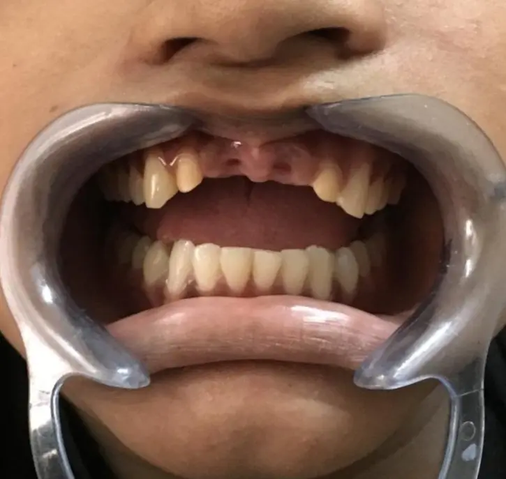 Before dental case 5